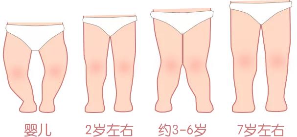 「星医百」纸尿裤影响生育、导致0型腿?纸尿裤的谣言,一次说清