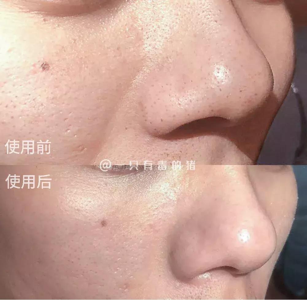 深层清洁面膜推荐网红,网红清洁面膜红黑榜