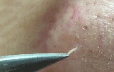 宋威龙、赵露思皮肤管理失败?毛孔粗大怎么办-四步改善毛孔粗大