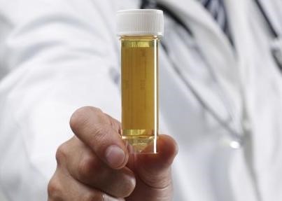 尿液浑浊是什么原因引起的,尿液浑浊和肾有关吗