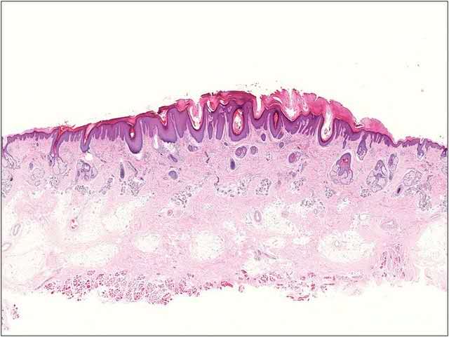 皮肤瘙痒要不要挠,皮肤瘙痒的让人抓狂10种止痒妙方