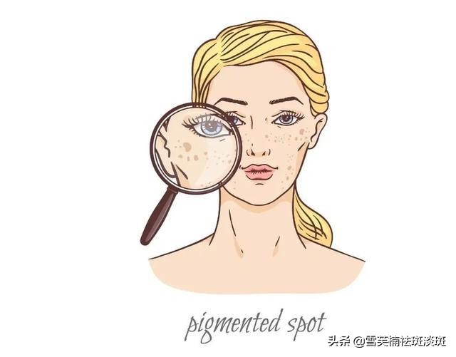 去斑点淡斑最有效方法,去斑点的最好方法最快最有效果