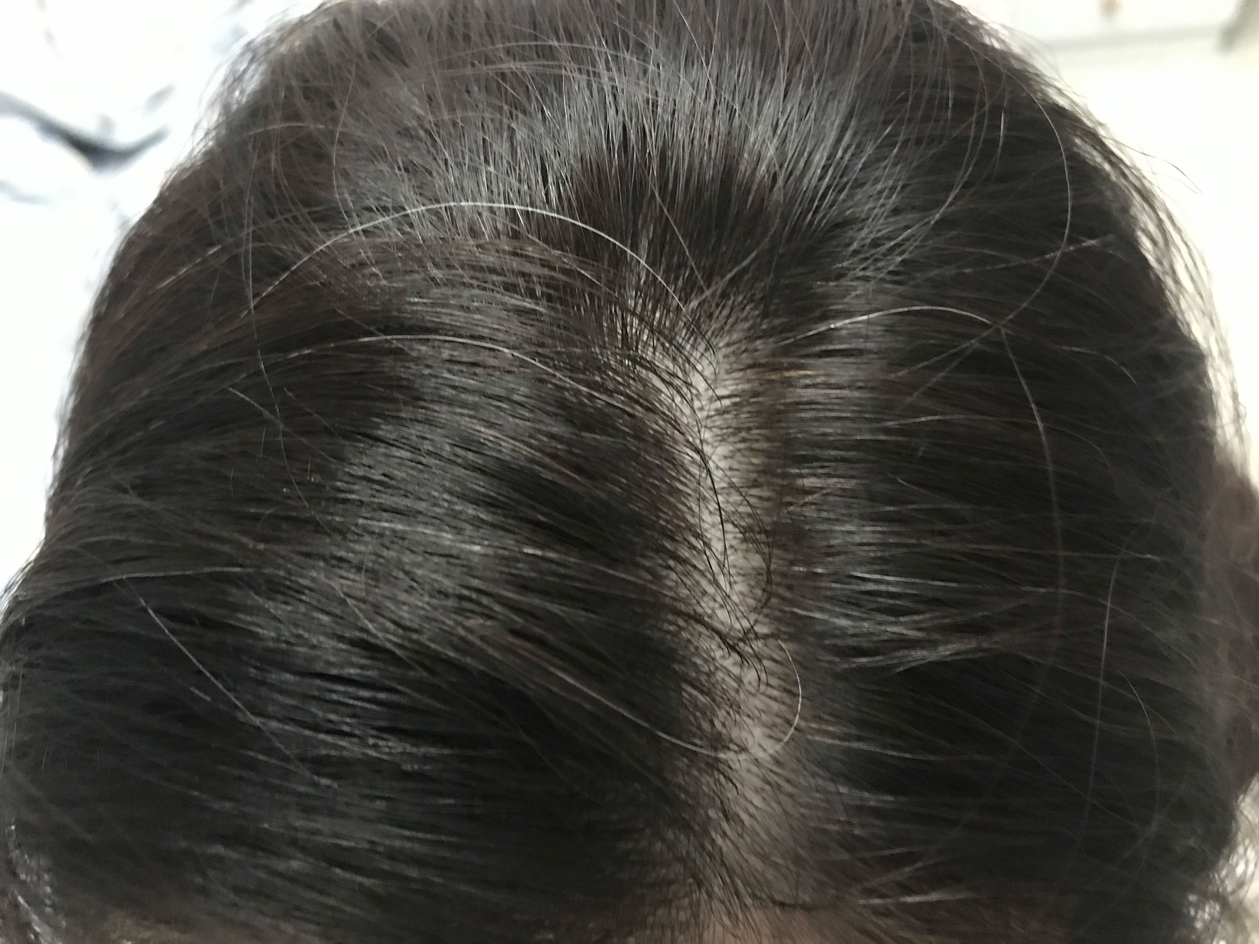 氨基酸洗发水有哪些功效养发,氨基酸养发洗发水