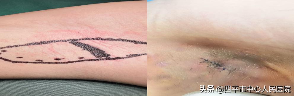 是时候跟腋臭说“再见”了，让我们清清爽爽上大学