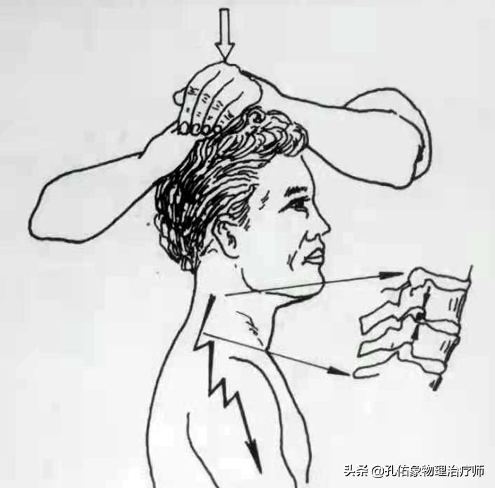 颈椎间盘突出手指尖麻乏力怎么治,颈椎间盘突出导致四肢无力疼痛