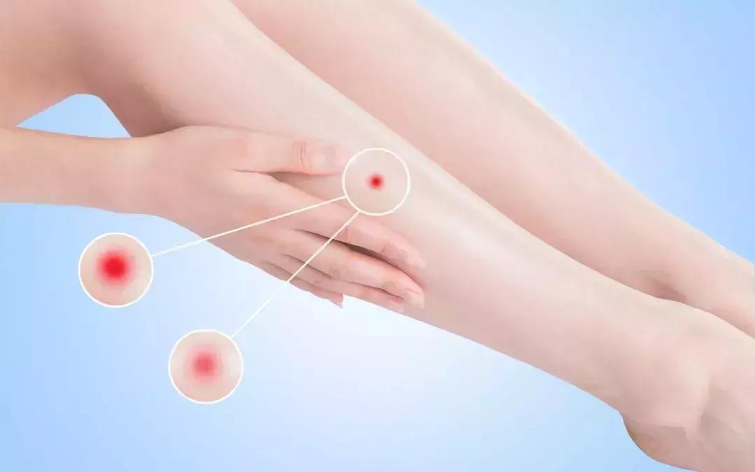 梅雨季病害,梅雨病最佳治疗方案