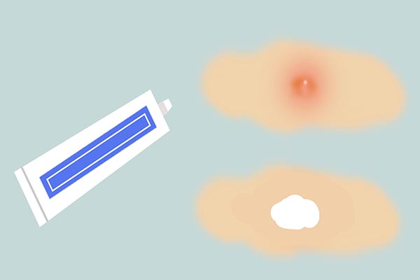 皮肤上长小红点是肝脏出问题了吗,身上突然出现小红点是肝病么