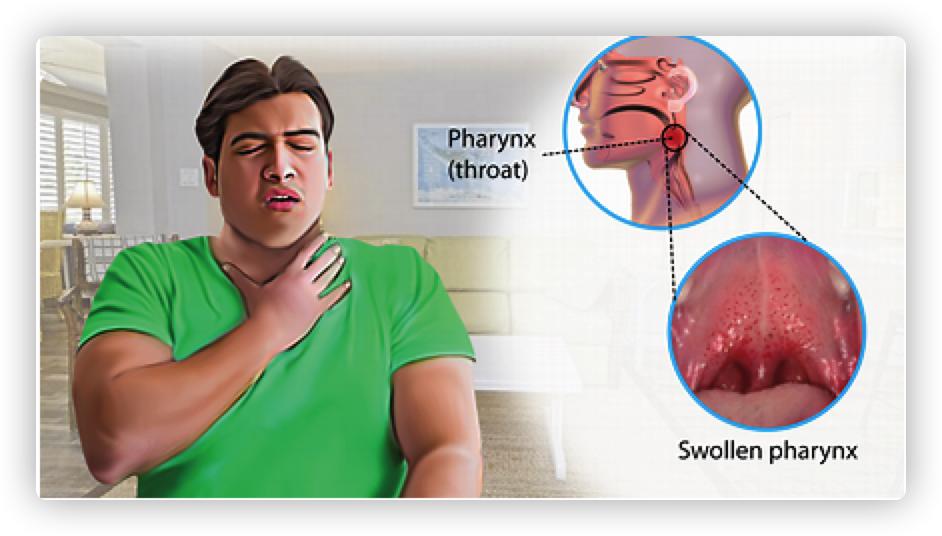 反流性食管炎是食管癌的前兆吗,反流性食管炎一直不好怎么办
