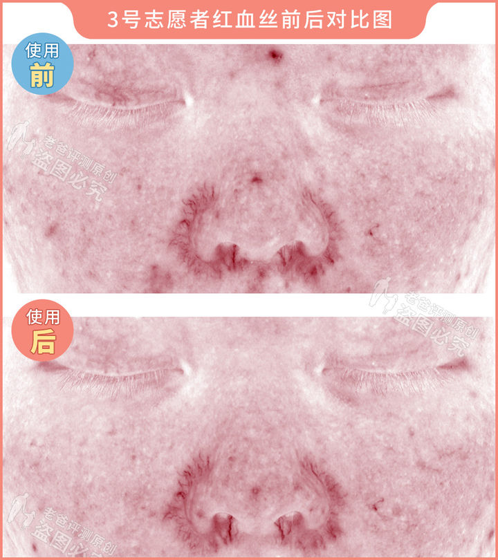 300块的网红美容仪有效果吗,网红家用美容仪测评