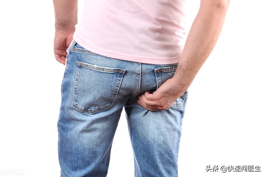 肛门周围潮湿又瘙痒怎么办,肛门周围潮湿瘙痒怎么治疗
