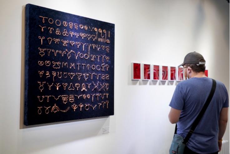 节育环在身体里40年了,遗忘在妈妈体内的节育环