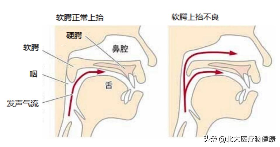 孩子发音不清楚的训练方法视频,一年级前后鼻音发音分不清怎么办
