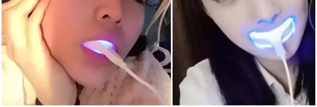 抖音美牙仪是真的吗,使用美牙仪的抖音网红靠谱吗