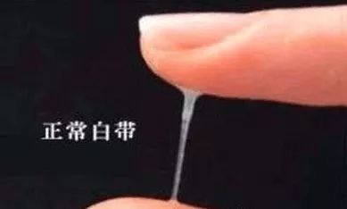 白带异常看中医,白带异常看妇科内分泌