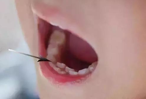 孩子无形中养成很多坏习惯,孩子养成的毛病来自父母的言行