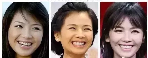 日本“黑科技”美牙产品：每天只需20秒，再也不用三天两头跑医院