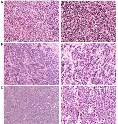 犬恶性黑色素瘤,狗黑色素瘤良性恶性区分
