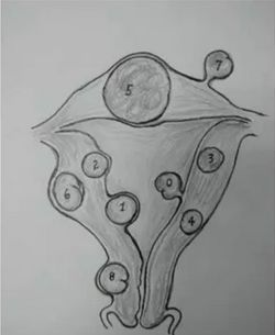 细思极恐，原来一半的女人都有子宫肌瘤！