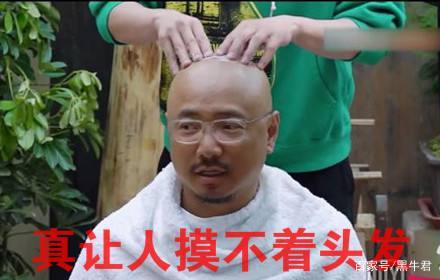 日本对秃头有什么样的治疗,让人秃头的十个方法