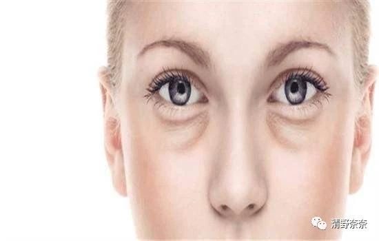 别光用眼霜！专家提醒：要想去除眼纹黑眼圈，这些方法最有效