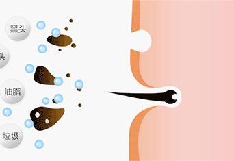 为什么你的痘印总是消不下去,为什么你的祛斑效果不理想