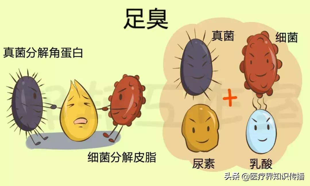 脚气怎么不用药治疗,鳞屑角化型脚气可以彻底治愈吗