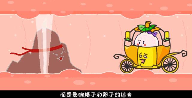 通畅、堵塞、通而不畅、积水？输卵管造影检查你是哪种情况？