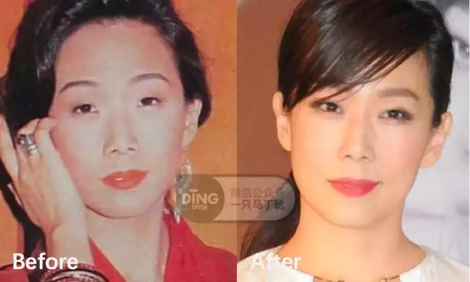 中庭短显年轻还是显老,中庭长怎么避免显老