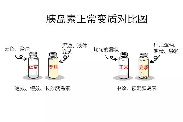 胰岛素打的疼不疼,胰岛素打起来痛