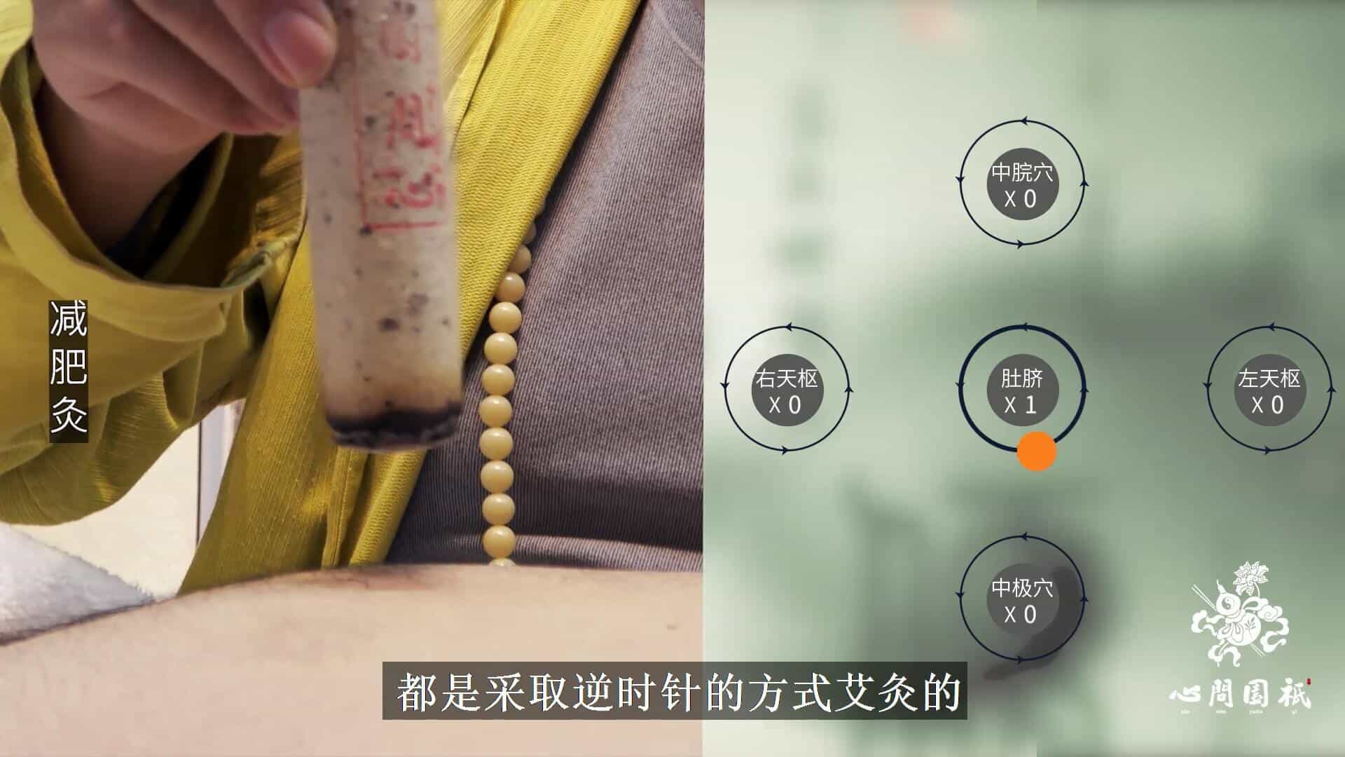 “环肥变燕瘦”，祇园减肥灸来帮您