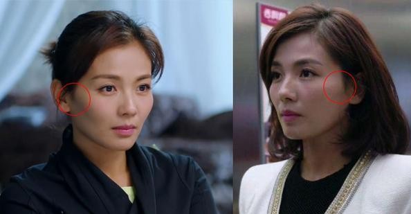 颧骨平和颧骨高哪个好看,颧骨塑造