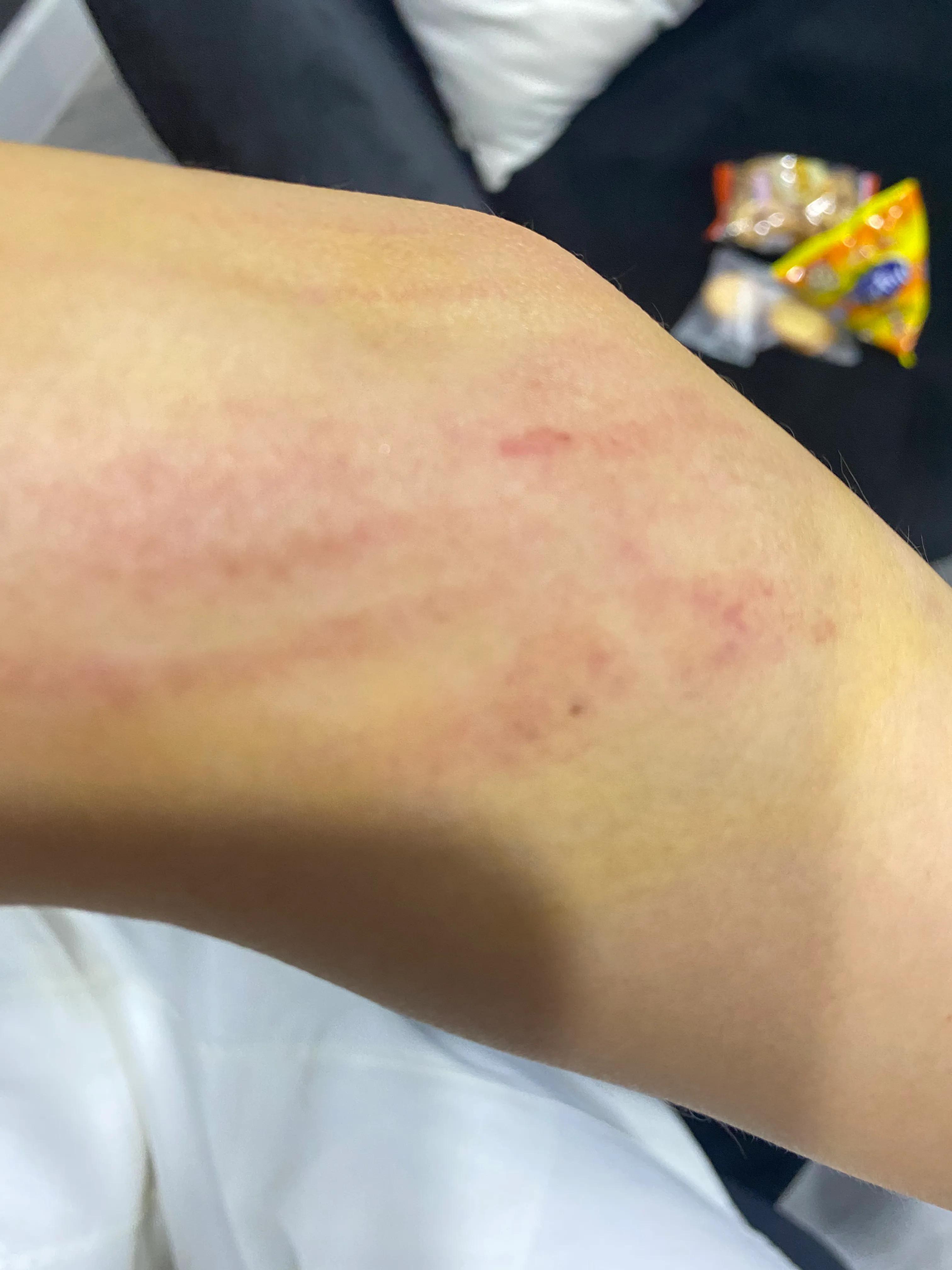 领克03低速行驶车辆无损伤无刮擦无碰撞弹出安全气囊并爆炸