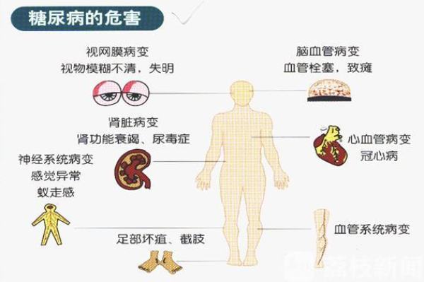 糖尿病小伙,28岁顽固糖尿病