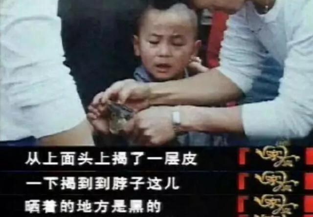 2岁孩子被虐待致死前仍求抱抱,2岁被虐待的女童