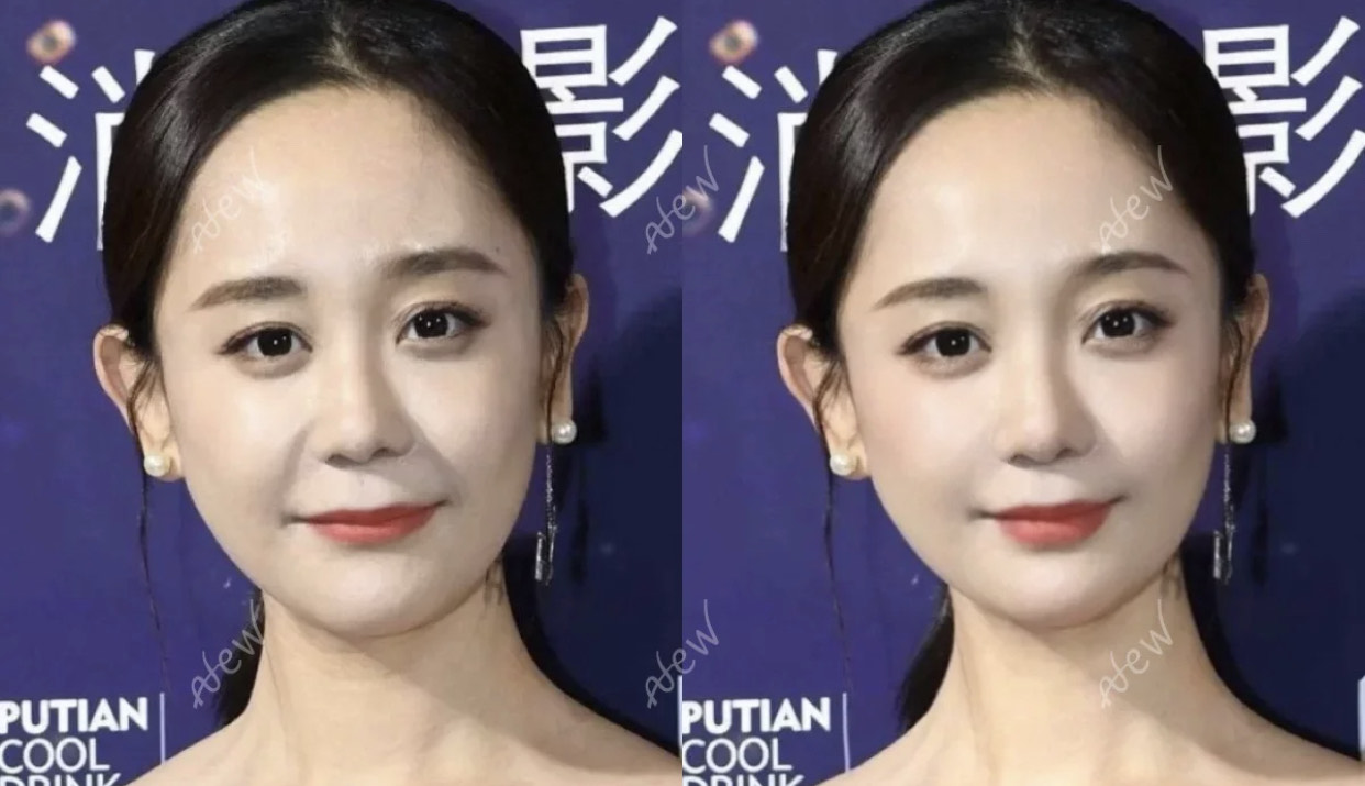 面无表情和爱笑哪个容易长皱纹,一笑眼下有皱纹怎么办