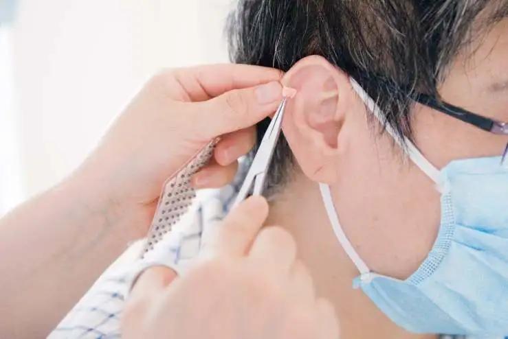 中医辨证针灸治疗病理性肥胖,针灸治疗单纯性肥胖的研究近况