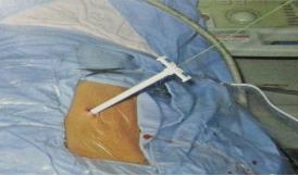 山东治疗泌尿外科比较好的医院,山东大学附属医院泌尿外科专家