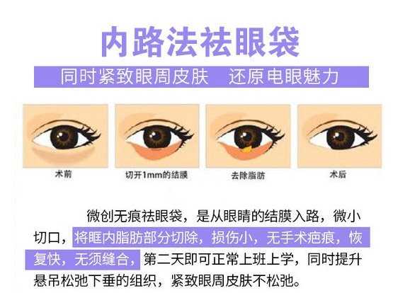 如何消除眼袋学生,如何消除眼袋男