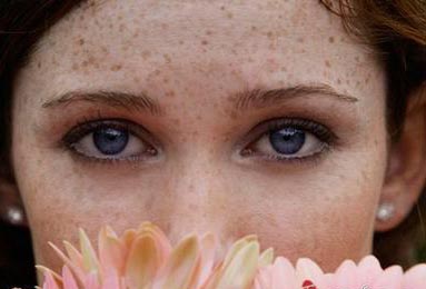 胎记真实身份,胎记是怎么形成的原因