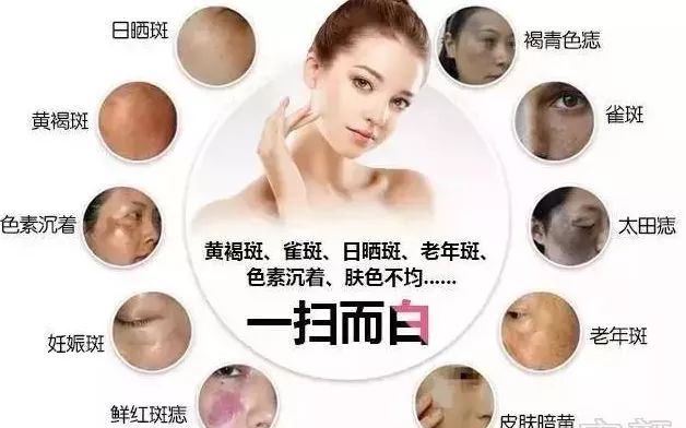 超皮秒激光祛斑真的有效果吗,超皮秒祛斑效果