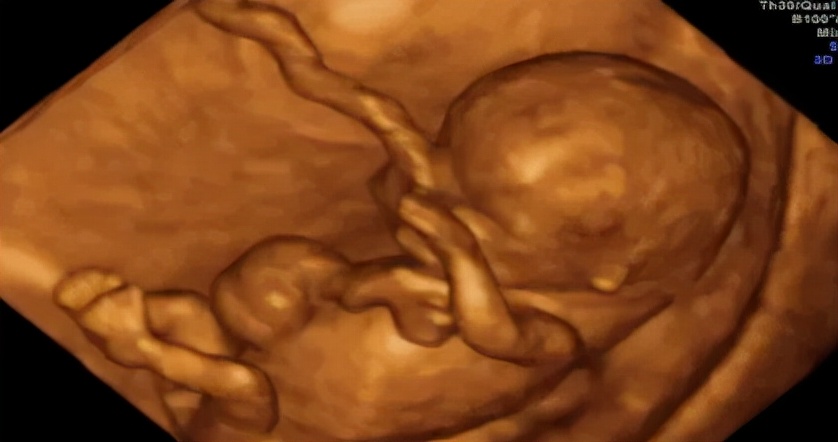 孕期小检查项目,孕期超声检查的那些事