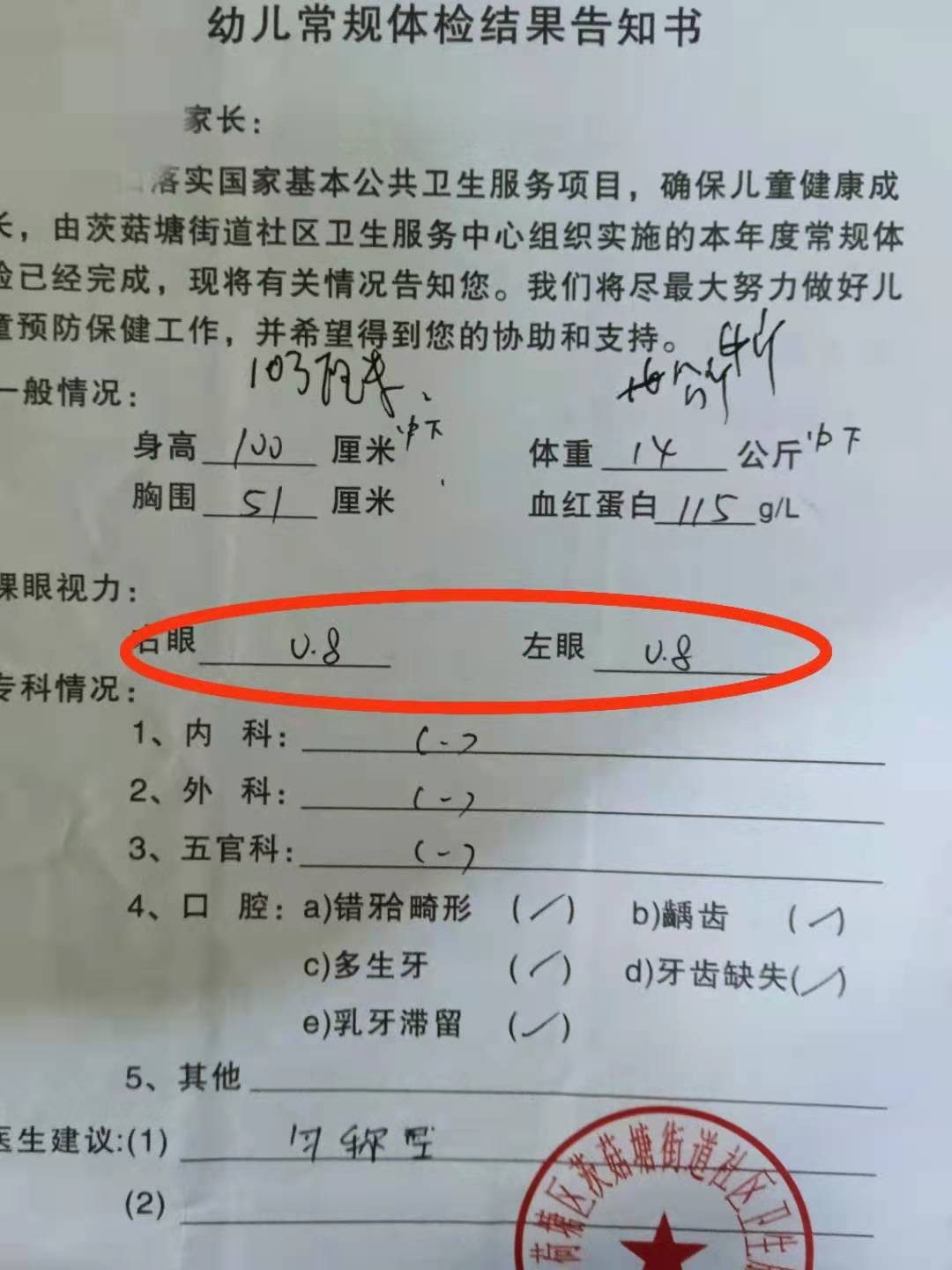 小孩子近视了一定要戴眼镜吗,小孩近视一定要戴眼镜吗