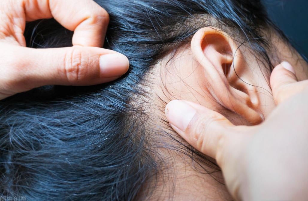 30年前每个人身上都有虱子,30年前人人都有的虱子为什么不见