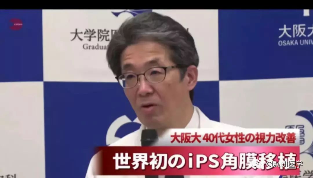 已成功两例！研究发现：移植正常眼部干细胞可治疗失明