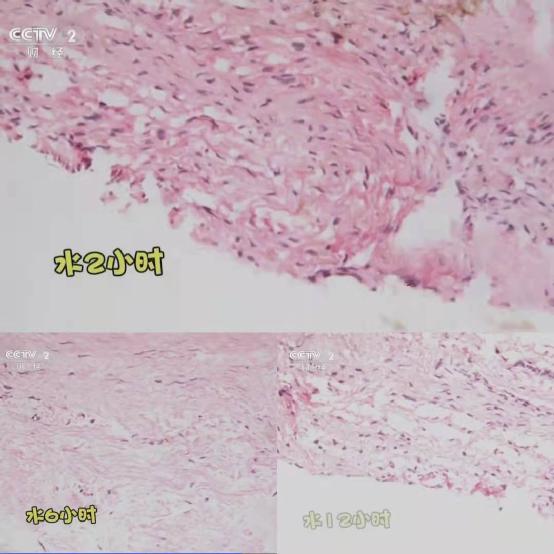 头上秃了一块还能长回来吗,二十三岁头秃还能长回来吗