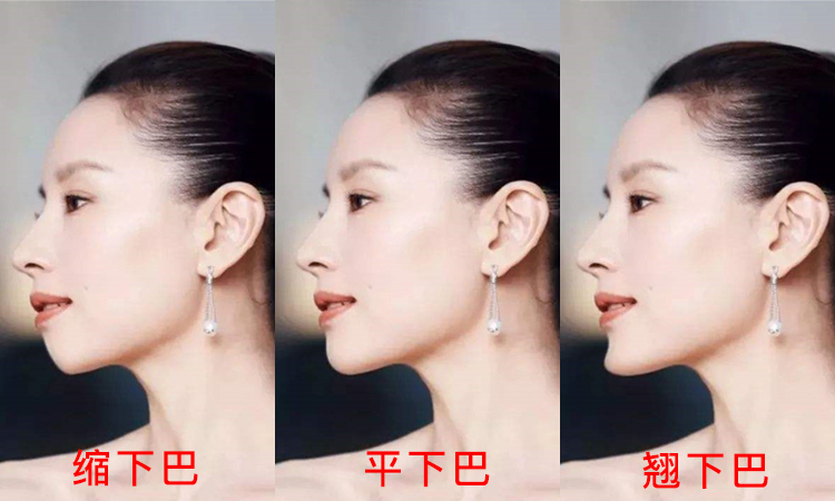 侧面好看和正面好看哪个好,女生侧面怎么才好看