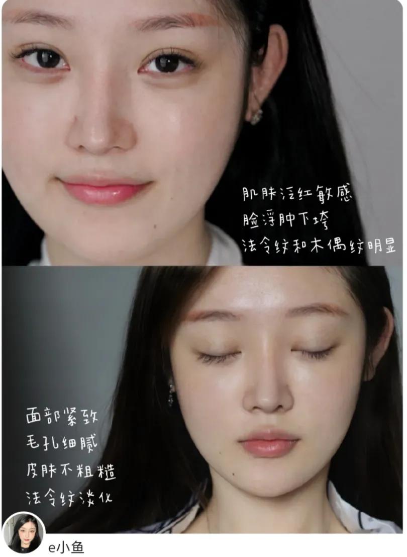 雅顿粉胶金胶啵啵胶哪个好用,雅顿粉胶和啵啵可以叠加使用吗