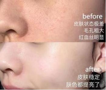 吴昕好闺蜜,吴昕娱乐圈的好闺蜜