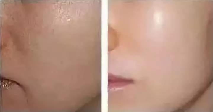 那些学化妆的女孩子后来怎么样了,学医美的女生怎么样