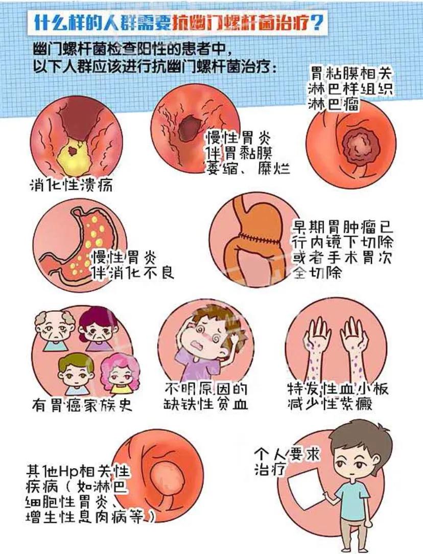幽门螺杆菌c14阳性105严重吗,幽门螺杆菌阳性500不看会变癌吗